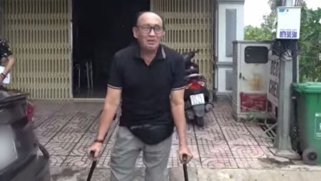 Danh hài Duy Phương gặp tai nạn giao thông phải chống nạng để di chuyển