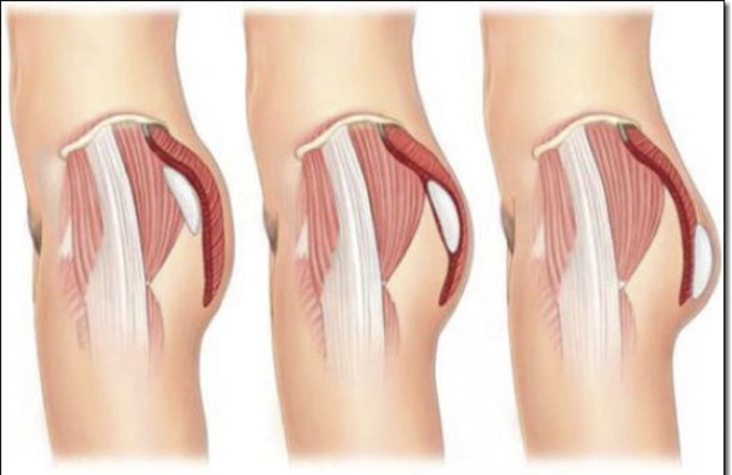 Bộ phận này to ra là dấu hiệu tuổi già ập tới - 1