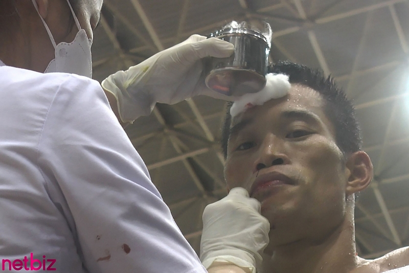 Những lần toét máu trên sàn One Muay Championship 2022 Chùm ảnh Liên hoan Võ thuật TP.HCM lần I và One Muay Championship 2022